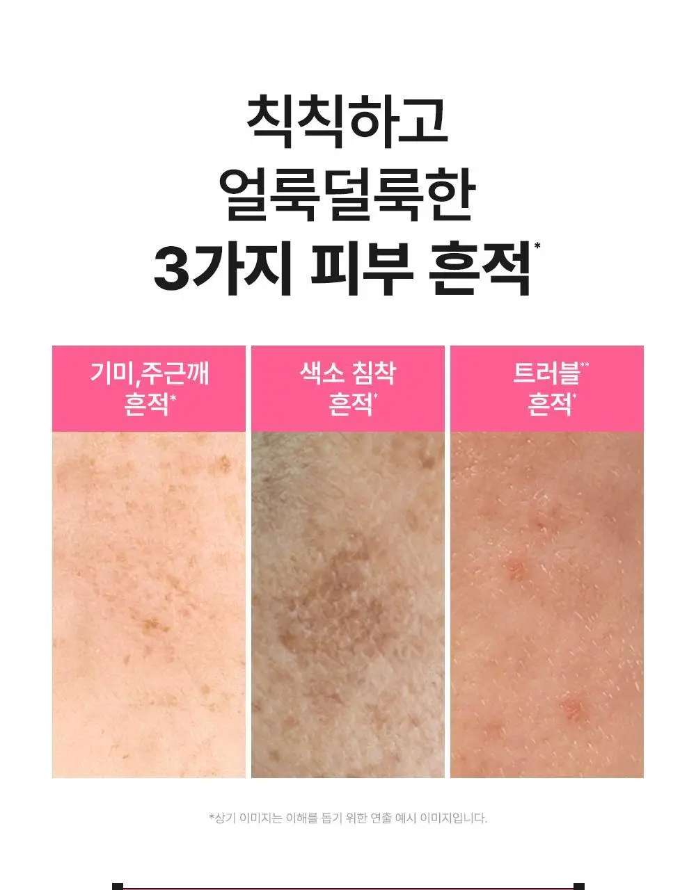 [하루특가/도훈PICK/7일잡티샷] 비긴스 바이 정샘물 나이아신아마이드10 흔적세럼 리필기획 상세페이지 9